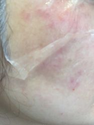 体验后-杭州米兰柏羽医疗美容医院