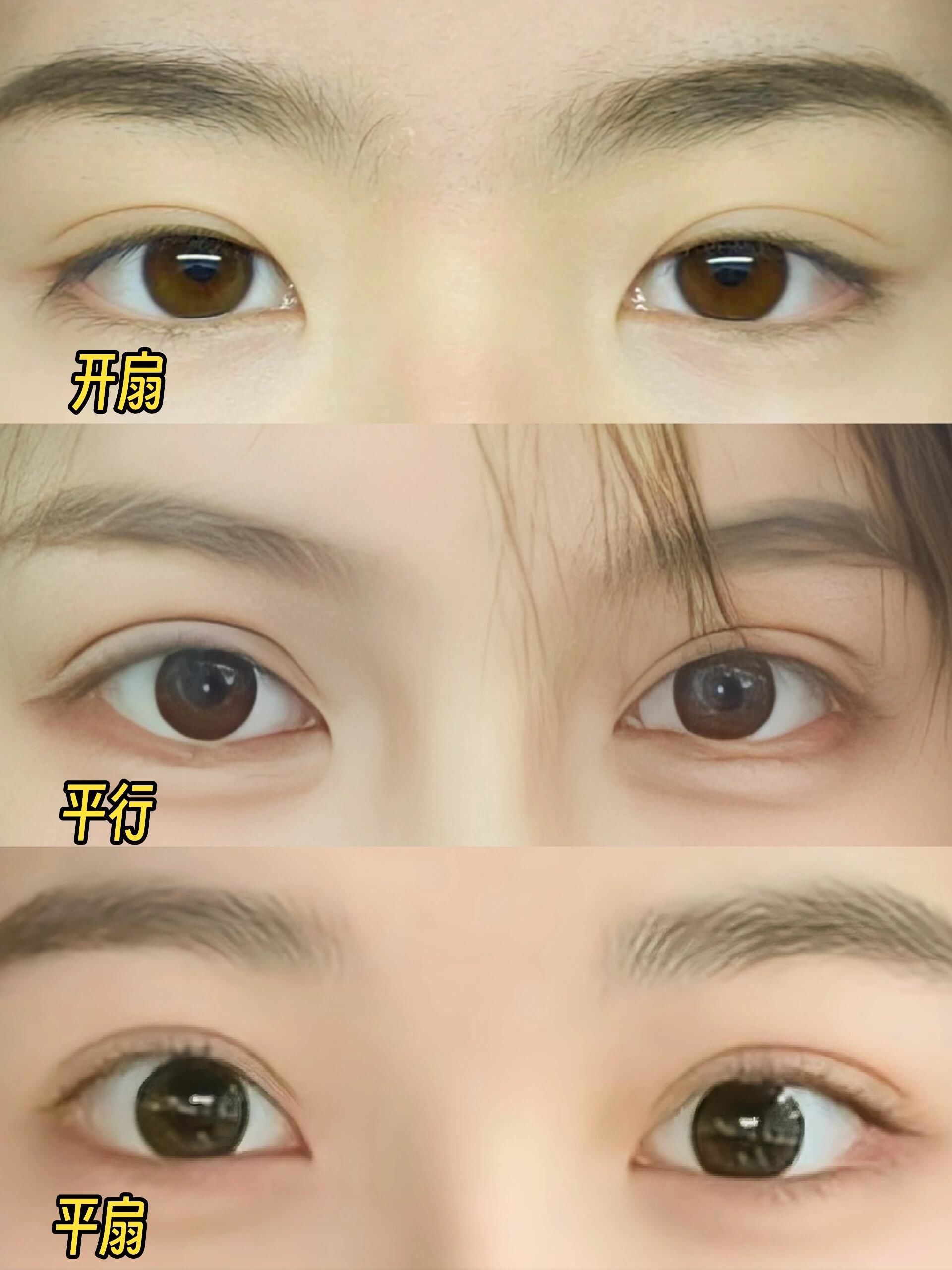 双眼皮妙招 自然升级