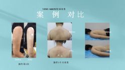-薇薇安花系SPA