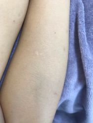 -植蔻妍皮肤管理美肤中心