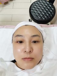 体验前-联合丽格·张菡丽格医疗美容
