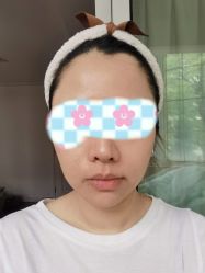 体验前-上海时光整形外科医院