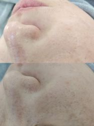 -SKIN79皮肤管理中心