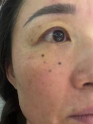 体验后-四川米兰柏羽医学美容医院