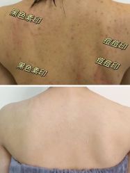-春田皮肤管理中心品牌旗舰店