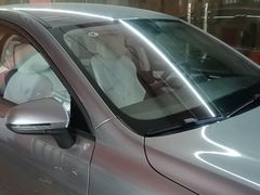 -鲨鱼皮汽车凹陷玻璃修复(静安店)