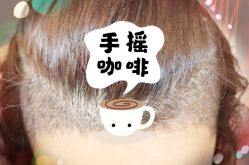 -大麦微针植发全国连锁