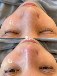 -skin79皮肤管理中心