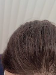 -熙朵美学植发连锁