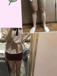 -洁铭新加坡医美