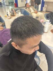 -大麦微针植发全国连锁