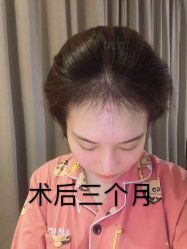 -雍禾植发全国连锁