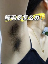 -薇兰专业脱毛连锁机构