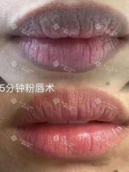 -杨益美学·野生眉半永久纹眉发际线
