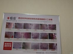 -痘庄科学祛痘国际连锁机构