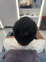 -大麦微针植发全国连锁