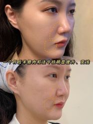 -大华韩艺整形美容医院