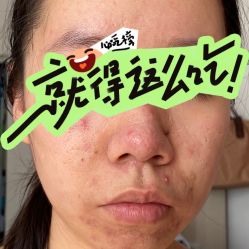 体验后-张小熊连锁轻医美