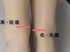 -张钰强中医正骨推拿连锁(唐家人才公寓店)