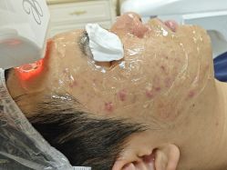 -长沙雅美医疗美容医院