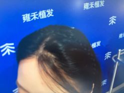 -雍禾植发全国连锁