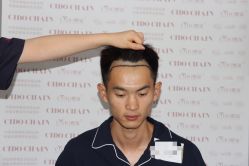 -熙朵美学植发·连锁品牌