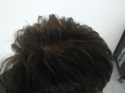 -发饰美男士增发补发假发定制店