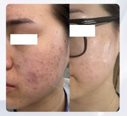 点击看大图 -SOS修丽可.痘肌修复中心