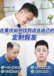 -唐风采假发补发定制