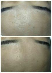 -奈瑞儿美颜塑身SPA