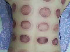 -鸿福推拿养生馆(砬子山店)