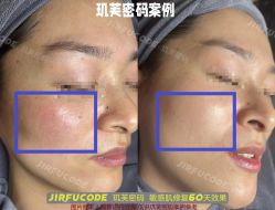 -元熙兰积皮肤管理