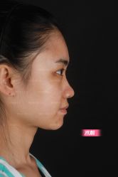 -北京米扬丽格医疗美容·联合丽格鼻整形中心