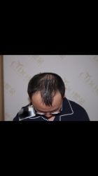 -熙朵美学植发连锁