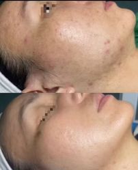 -Return·蕾特恩祛痘·皮肤管理中心