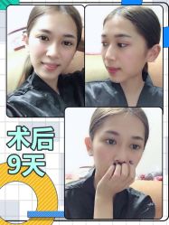 -广东韩妃整形外科医院