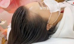-MISS STAR·半永久纹眉·发际线·美瞳线