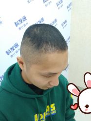 -大麦微针植发丨全国连锁