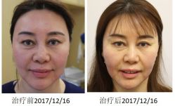 -丰联丽格医疗美容·联合丽格眼整形中心