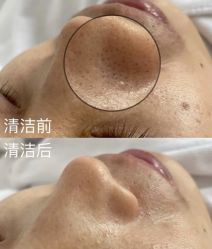 -SKIN79皮肤管理中心