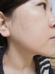 -新美荟医美·专注面部美学抗衰