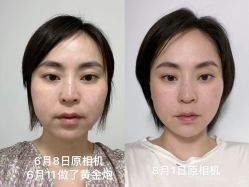 -上海伊莱美医疗美容医院