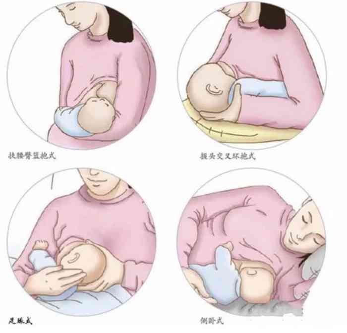 宋氏家传催乳工作室(嘉定店)-"宝宝出生第十三天,老婆乳头都被宝宝吸