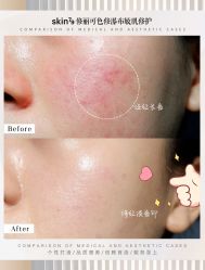 -SKIN79皮肤管理中心