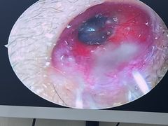 -溥耳·可视采耳·头疗·沐眼