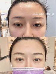 -MIVI半永久纹眉纹绣