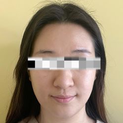 点击看大图 体验前-北京爱育华医院-医疗美容科