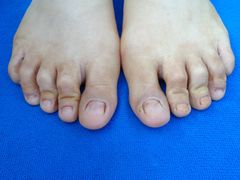 -世龙世家甲沟炎·灰指甲·嵌甲矫正·修脚(武侯区双楠店)