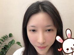 -大麦微针植发丨全国连锁