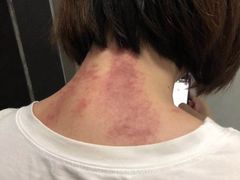 -益友堂盲人推拿正骨穴位按摩工作室